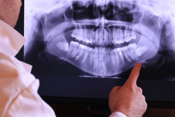 Best Emergency Gum Treatment in Vandalia, IL
